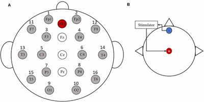 Enhancement of Event-Related Desynchronization in Motor Imagery Based on Transcranial Electrical Stimulation